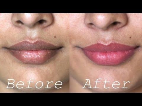 How to make your dark lips lighten permanently