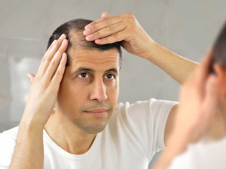 warning signs your hair loss is something more serious