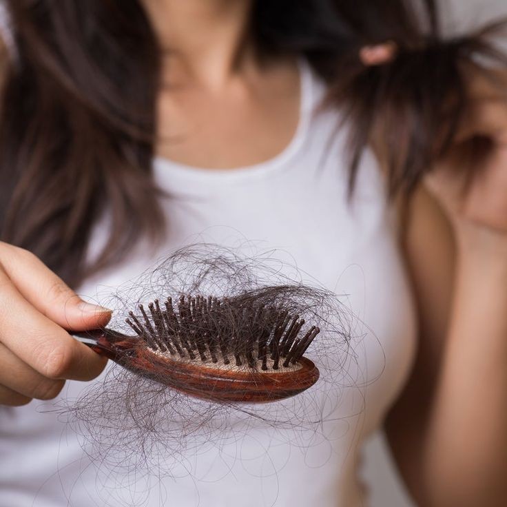 Everything You Need to Know About Hair Loss